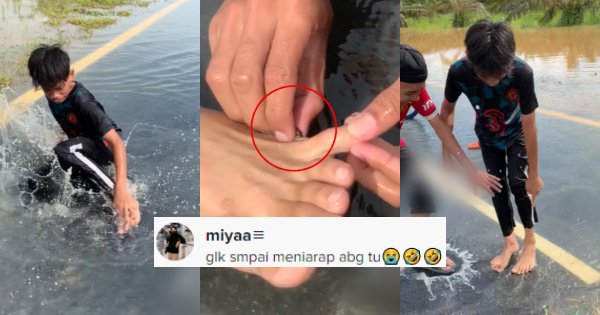 VIDEO Gelak Dulu Baru Tolong Pemuda Menggelupur Kaki Ada Pacat