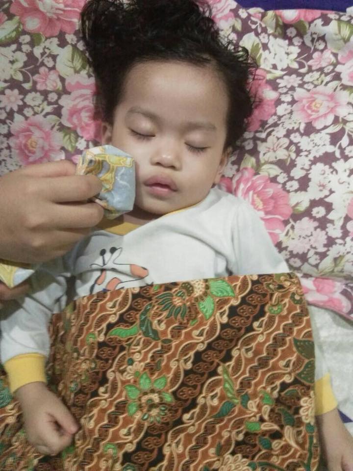 Anak Kecil Jadi Mangsa Penyakit Bell Palsy Akibat Ibu 