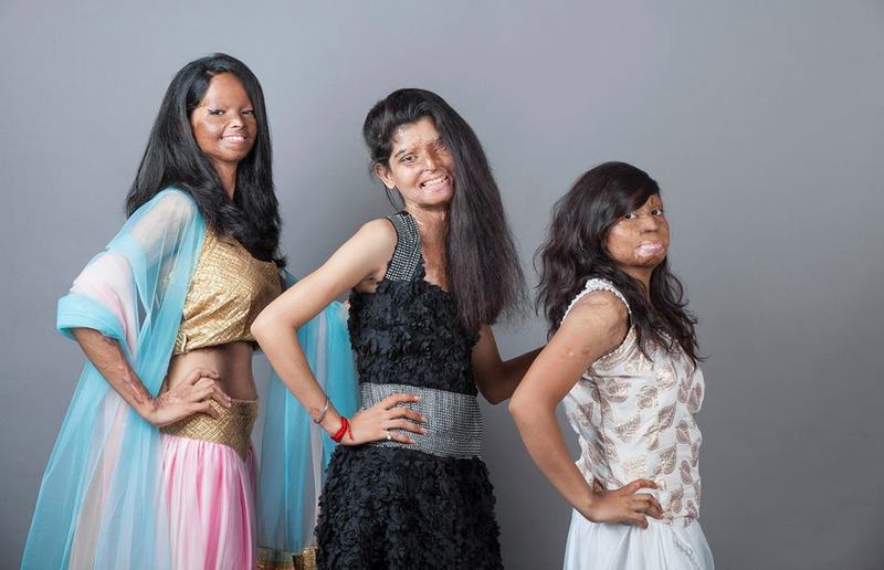 Photos Acid Attack Survivors Pose For Inspiring Photoshoot To Challenge Beauty Standards 