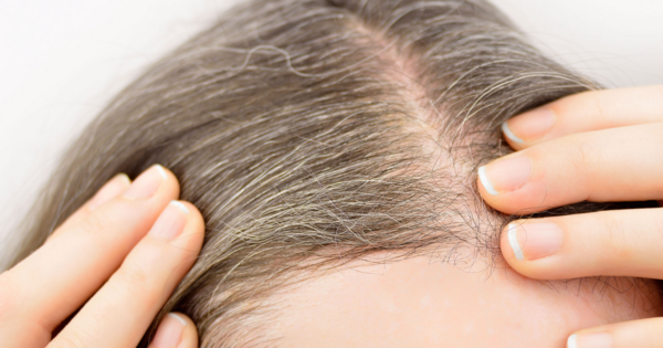 Why Do We Get (Premature) Grey Hair?