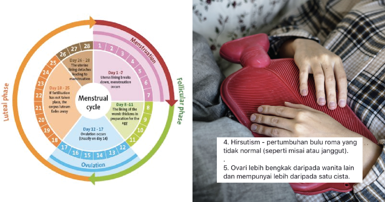 Ladies, Jangan Ambil Mudah Jika 'Period Cycle' Tak Teratur 