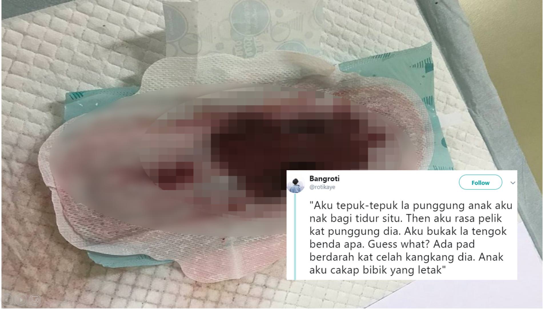 "Bibik Letak 'Pad' Berdarah Kat Punggung Anak Aku 