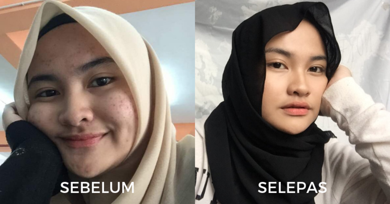 cara nak jadi cantik