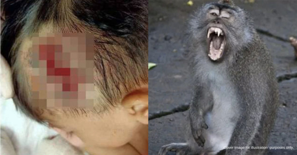 Toddler In Pahang Viciously Attacked By Wild Monkey While Sitting 