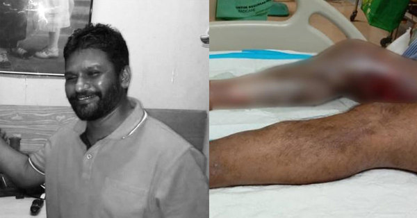 Ganapathy's Lawyer Says Autopsy Confirms Victim Died Of Injuries On Shoulders & Legs - Vimarsana News