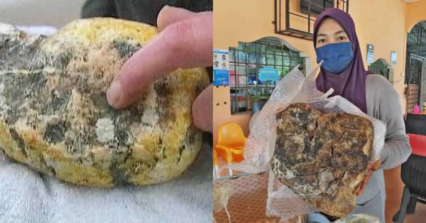 Qu’est-ce que le vomi de baleine?  Une femme de Terengganu trouve 5 kg de cet « or flottant » en pêchant