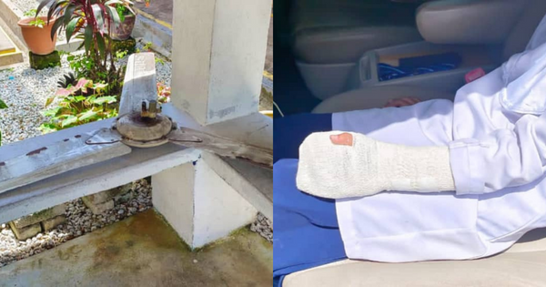 Standard 2 Student's Finger Breaks After Classroom Ceiling Fan Drops On Her