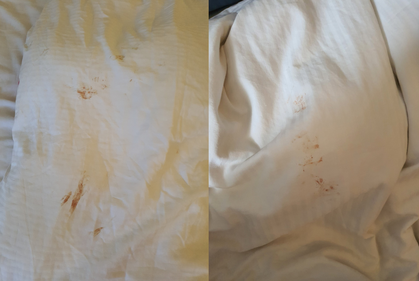 Woman Horrified To Find Blood Other Fluid Stains On Bed Sheets In 