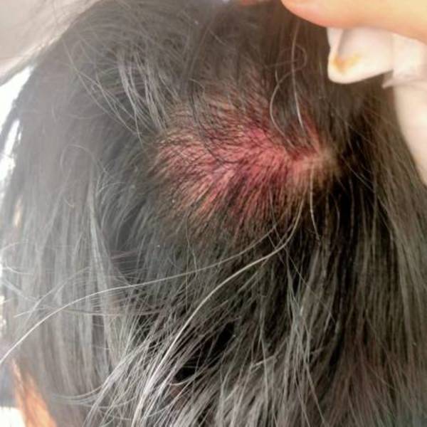 The head injuries the customer sustained after her fight with the stall owner.