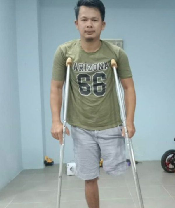 The pothole victim, Tengku Muhammad Khazi Hakimi, after his left leg was amputated.