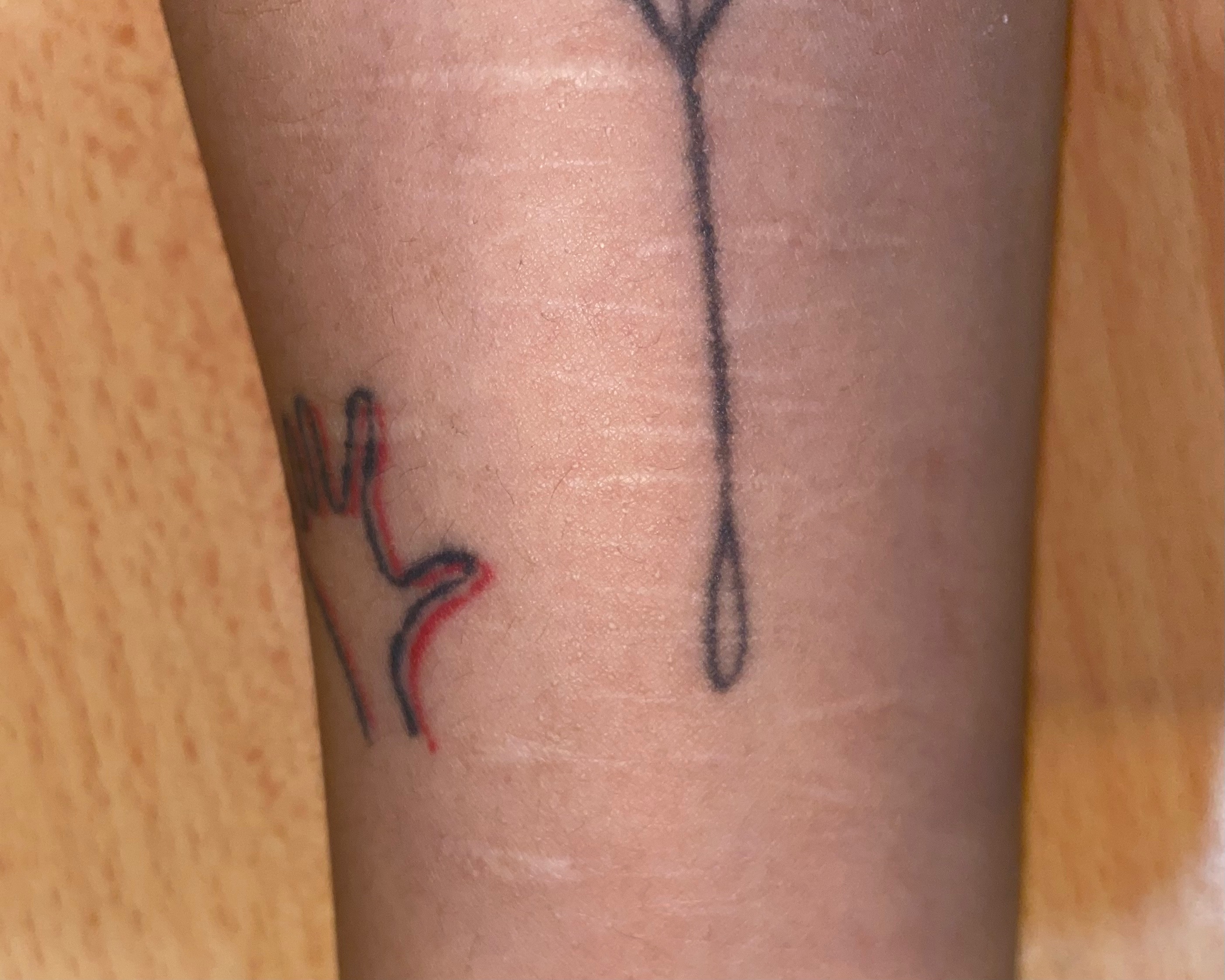 Monica's self harm scars and tattoos.