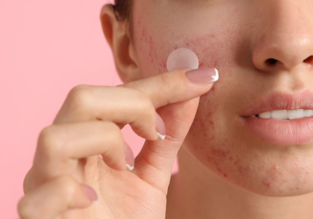 Gambar sekadar hiasan.