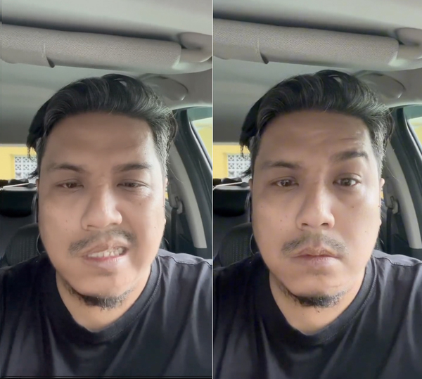 Faliq showing how one side of his face stays unchanged as he tries to smile and raise his eyebrows in a video.