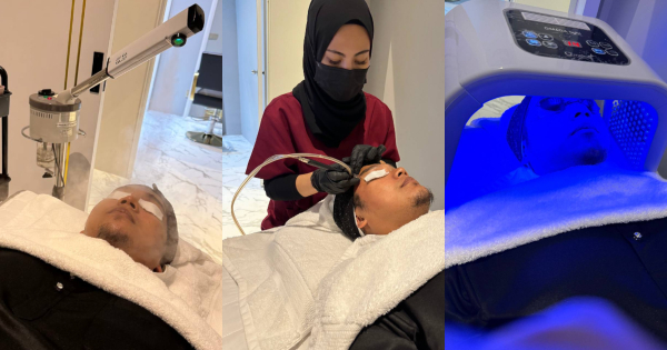 Antara prosedur yang dijalankan termasuklah dari kiri steam, dermabrasion dan penggunaan led mask.