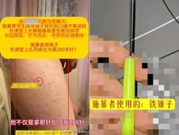 Screenshot from the video, showing puncture marks on the girl's thigh, and the needle/sewing awl the boy used to stab her.