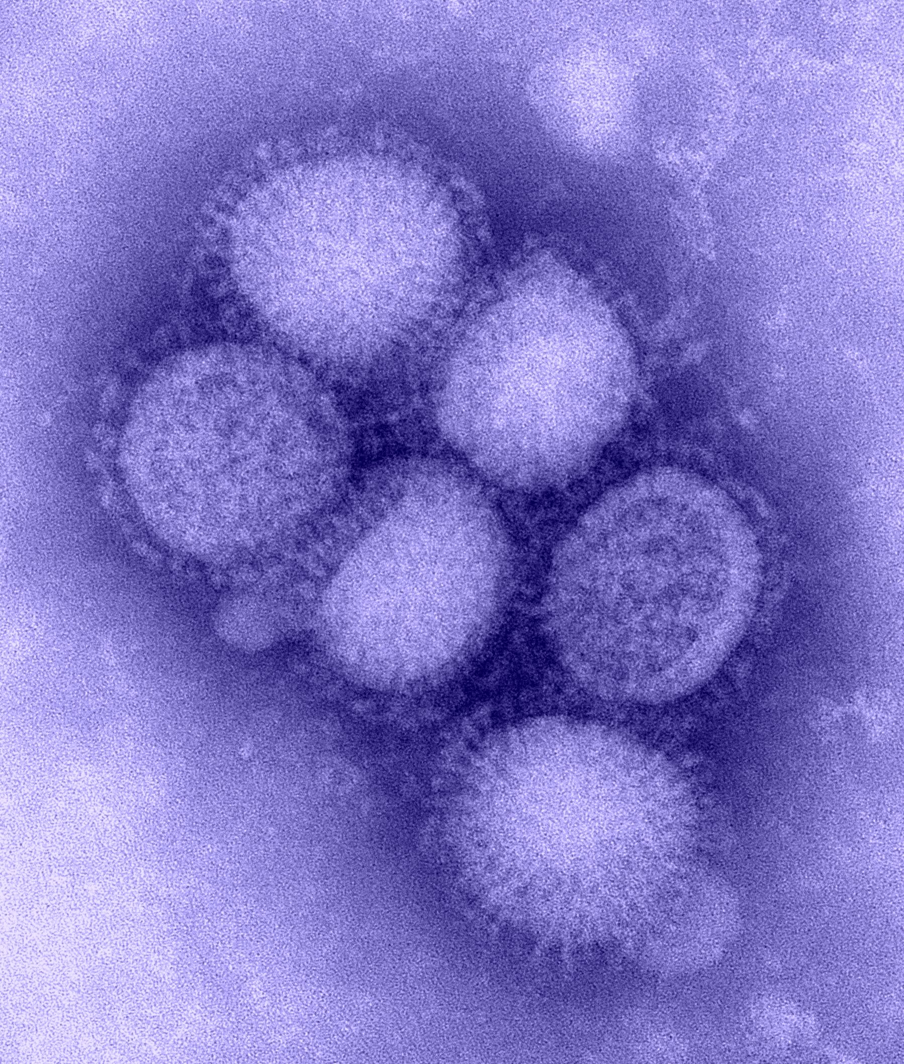 Seven People Tested Positive For H1n1 Flu Virus In Sabah