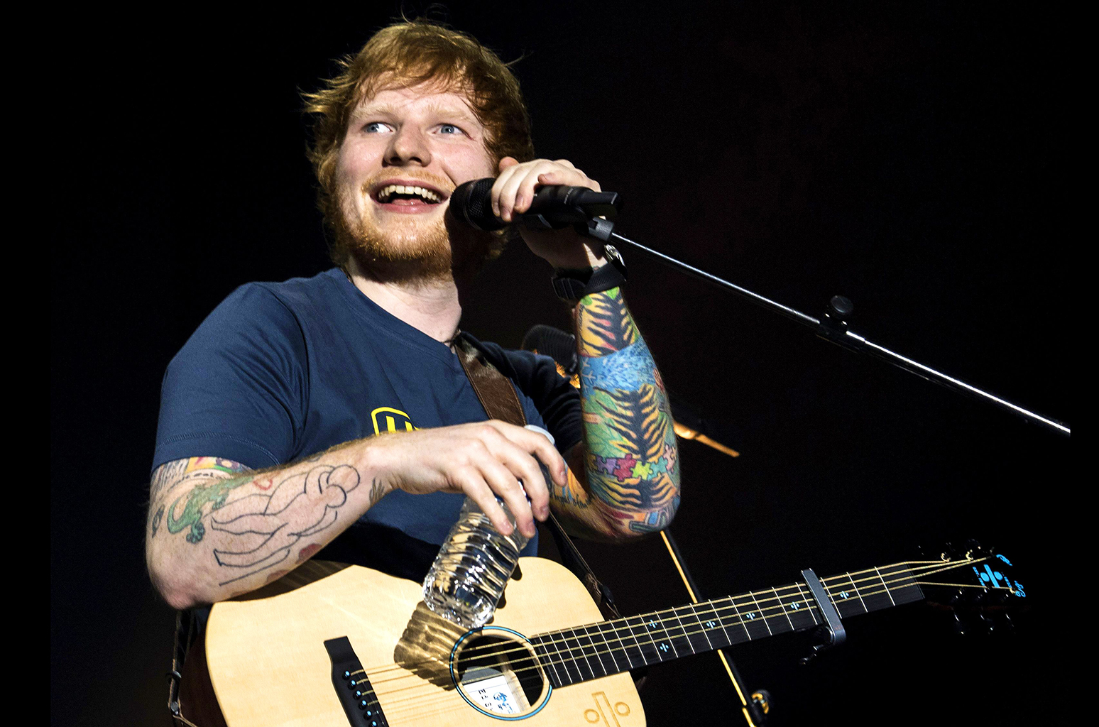 We Really Hope Ed Sheeran Recovers In Time For His KL Concert!
