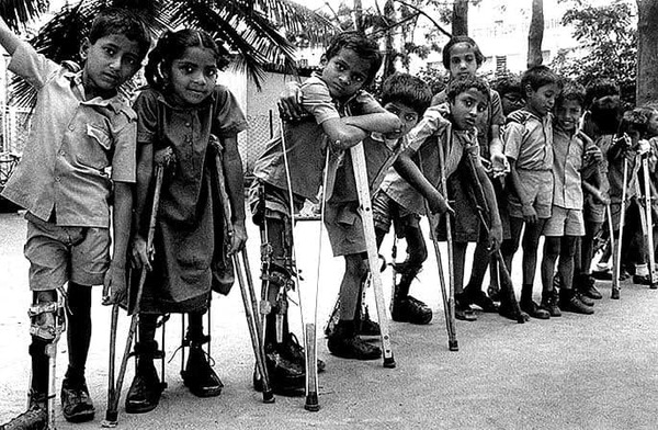 Polio yang pernah melanda di negara India.