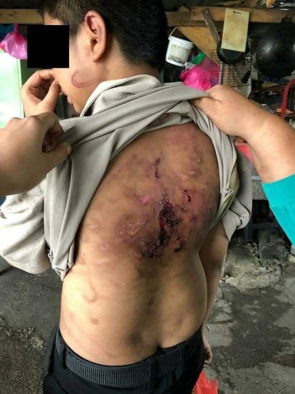 A viral photo that showed both old and new scars on the boy.