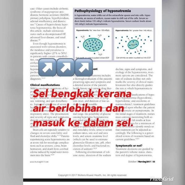 Dr Rafidah posted a picture about how water causes a cell to swell.