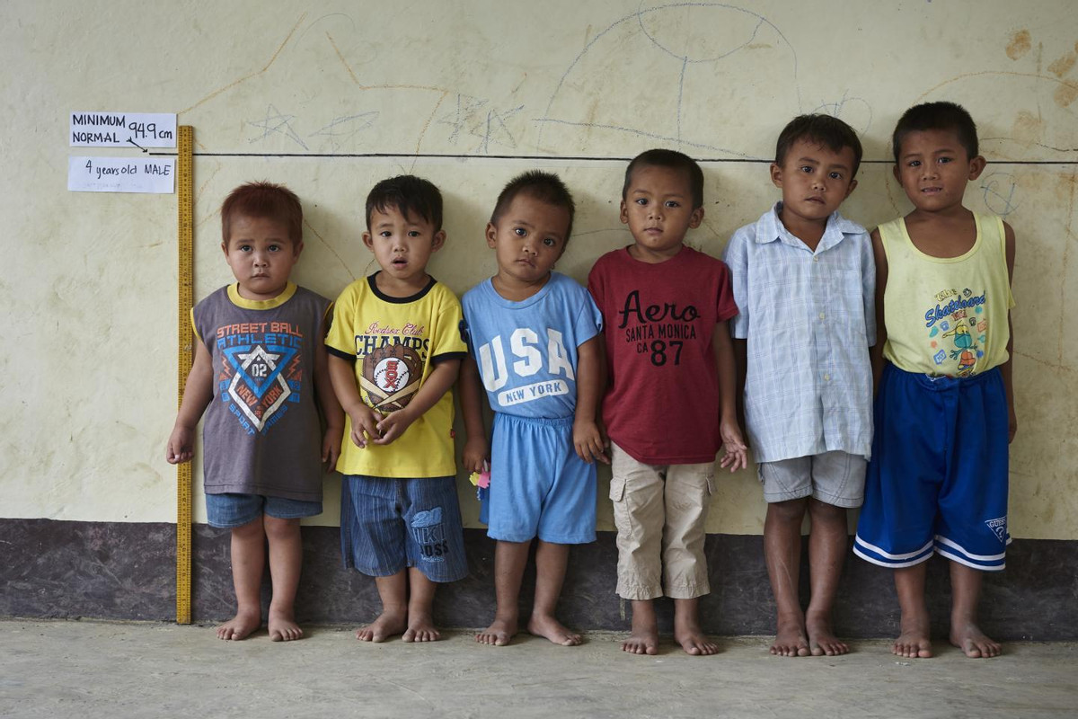 Study Reveals 20 Of Malaysian Children Suffer From Stunted Growth