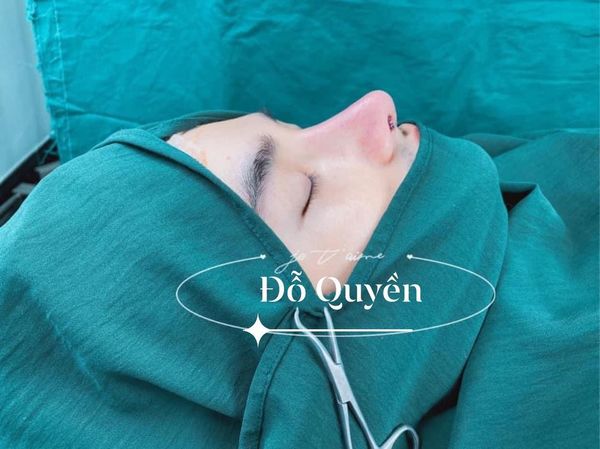 Quyen recently went for another nose augmentation surgery in December last year.