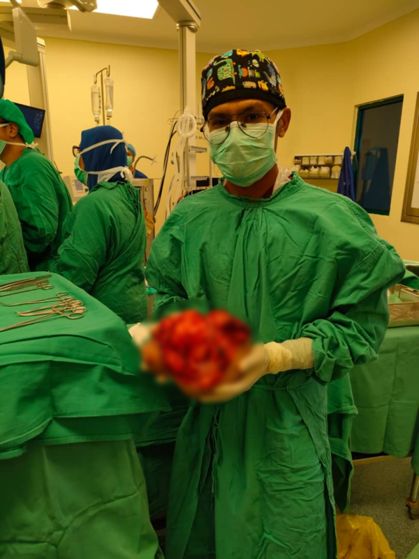 Dr Shaiful holding the 3kg salivary gland tumour after he and his team successfully removed it from the patient's neck.